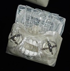 Mastonon.kaps - Petrifries Marrow